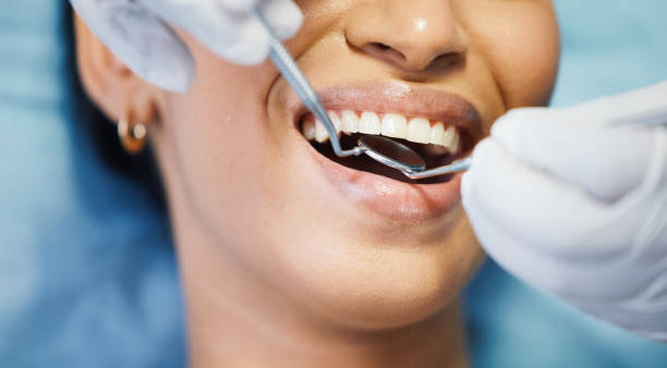 Best After-Hours Emergency Dentist in Merton, WI